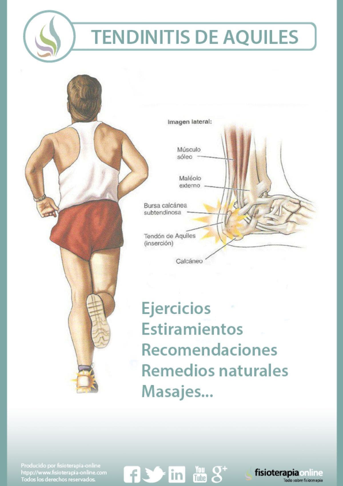 La tendinitis o tendinosis de Aquiles, qué es, cómo se produce y unas útiles herramientas para tratarla