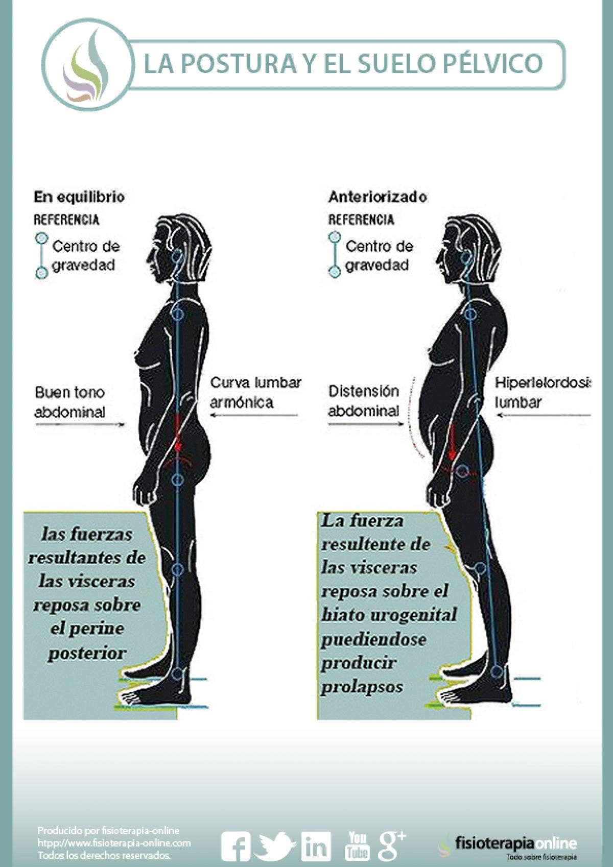 LA DISFUNCIÓN DEL SUELO PÉLVICO ES SÓLO COSA DE MUJERES