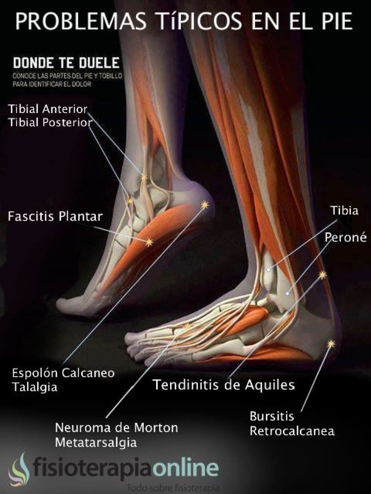 Lesiones y disfunciones del pie, conoce a los principales causantes