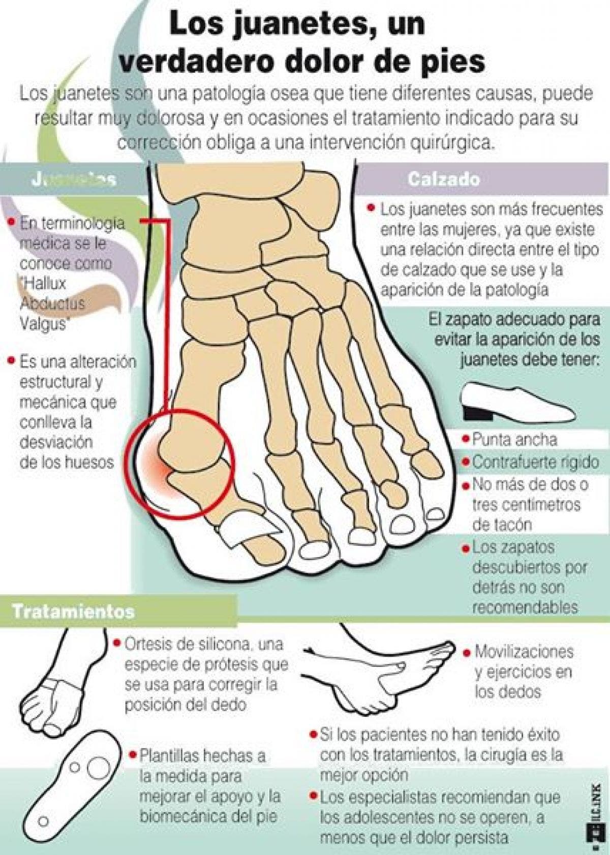 Hallux valgus o juanete, aprende un eficaz automasaje para tratarlo