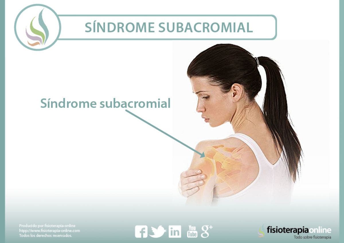 El síndrome subacromial. Aprende qué es, cómo se produce y qué puedes hacer para un correcto tratamiento