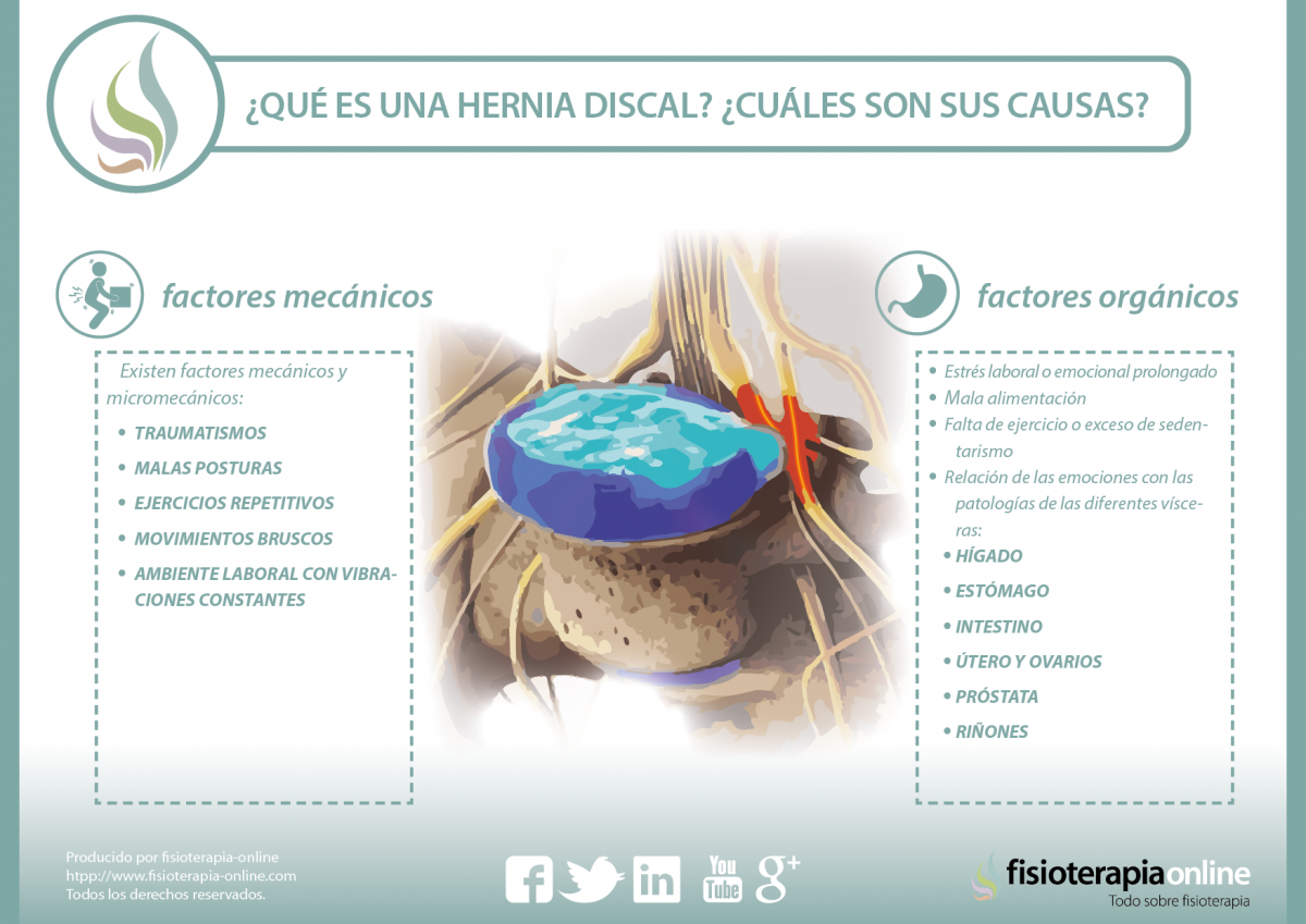 ¿Conoces todo lo necesario acerca de las hernias discales? Te ofrecemos una útil información