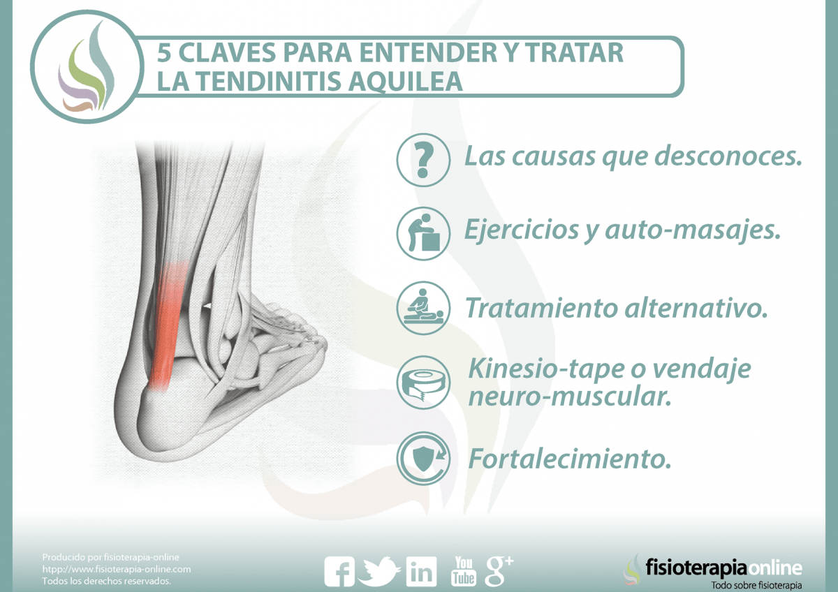 5 claves para entender y tratar la tendinitis aquilea