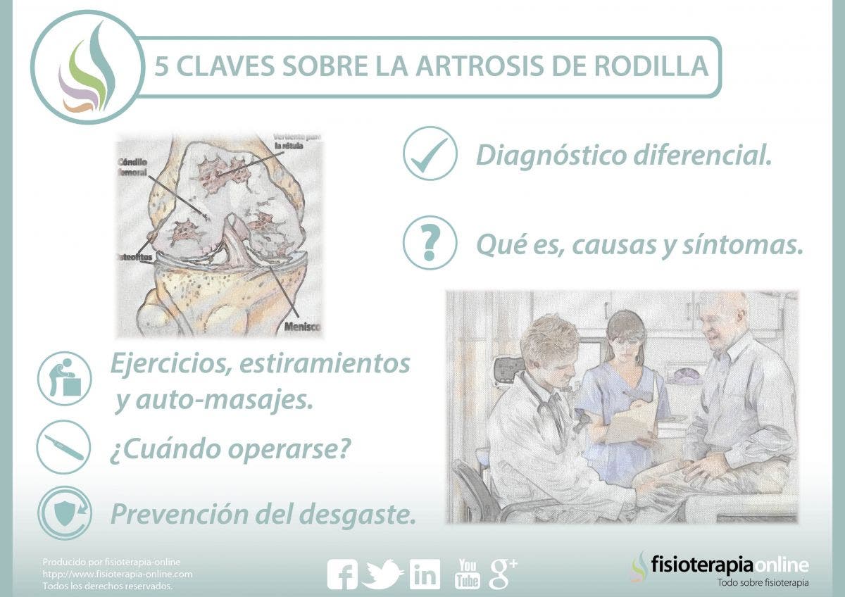 5 claves sobre la artrosis de rodilla