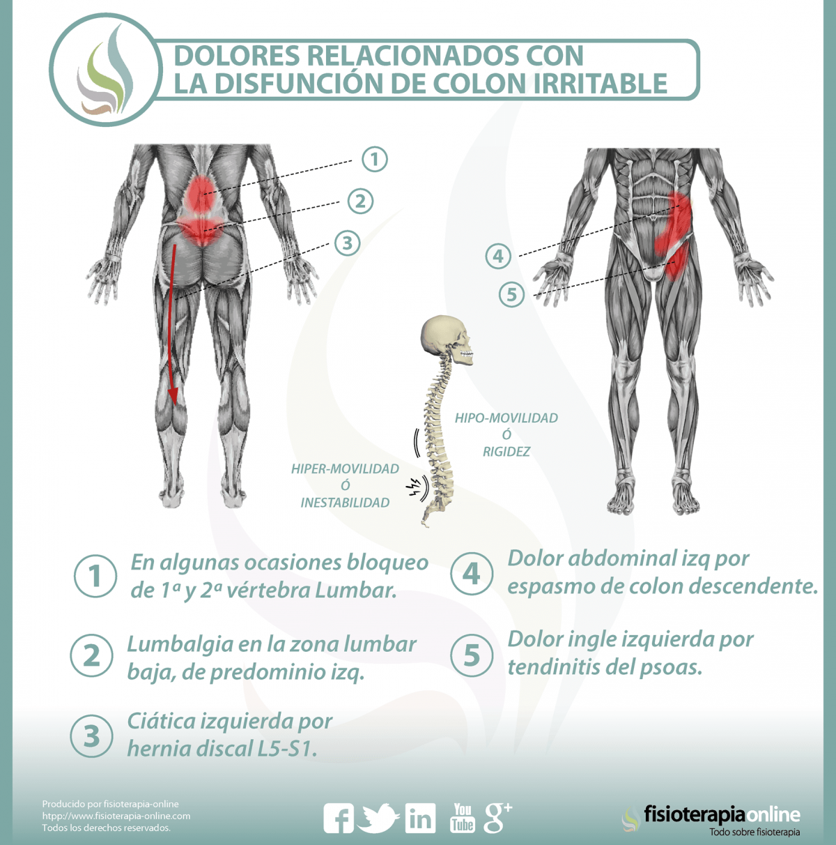 Relación entre el colon irritable y el dolor de espalda