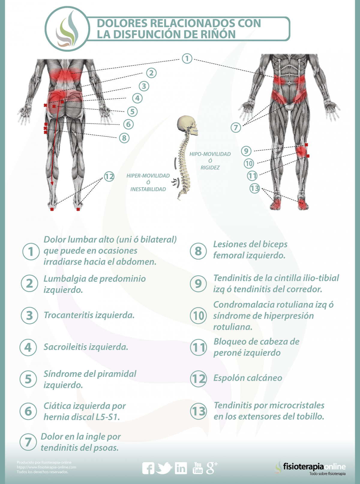 Relación entre el riñón y dolor de espalda