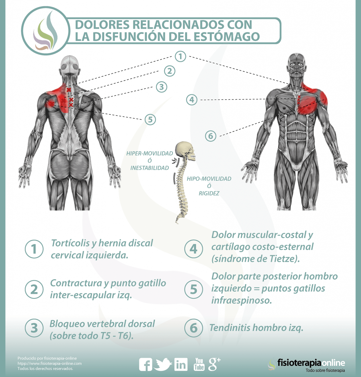 Relación entre el estómago y el dolor de espalda