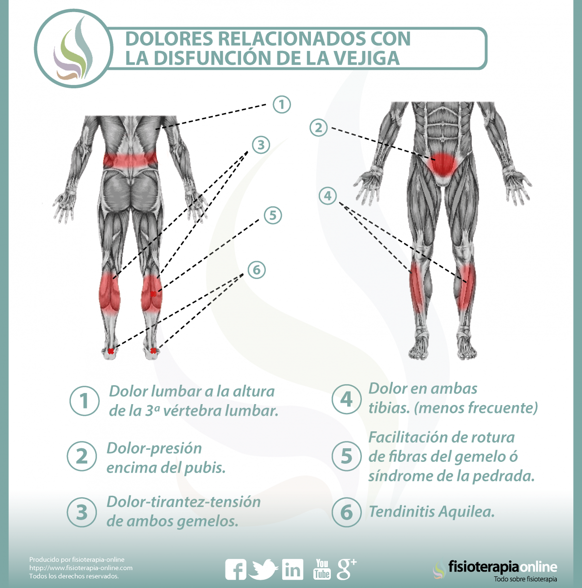 Relación entre vejiga y dolor de piernas y espalda