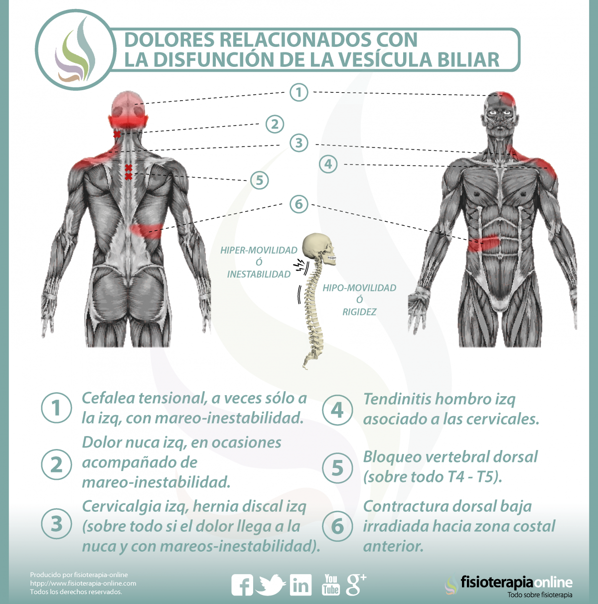 Relación entre vesícula y dolor de espalda