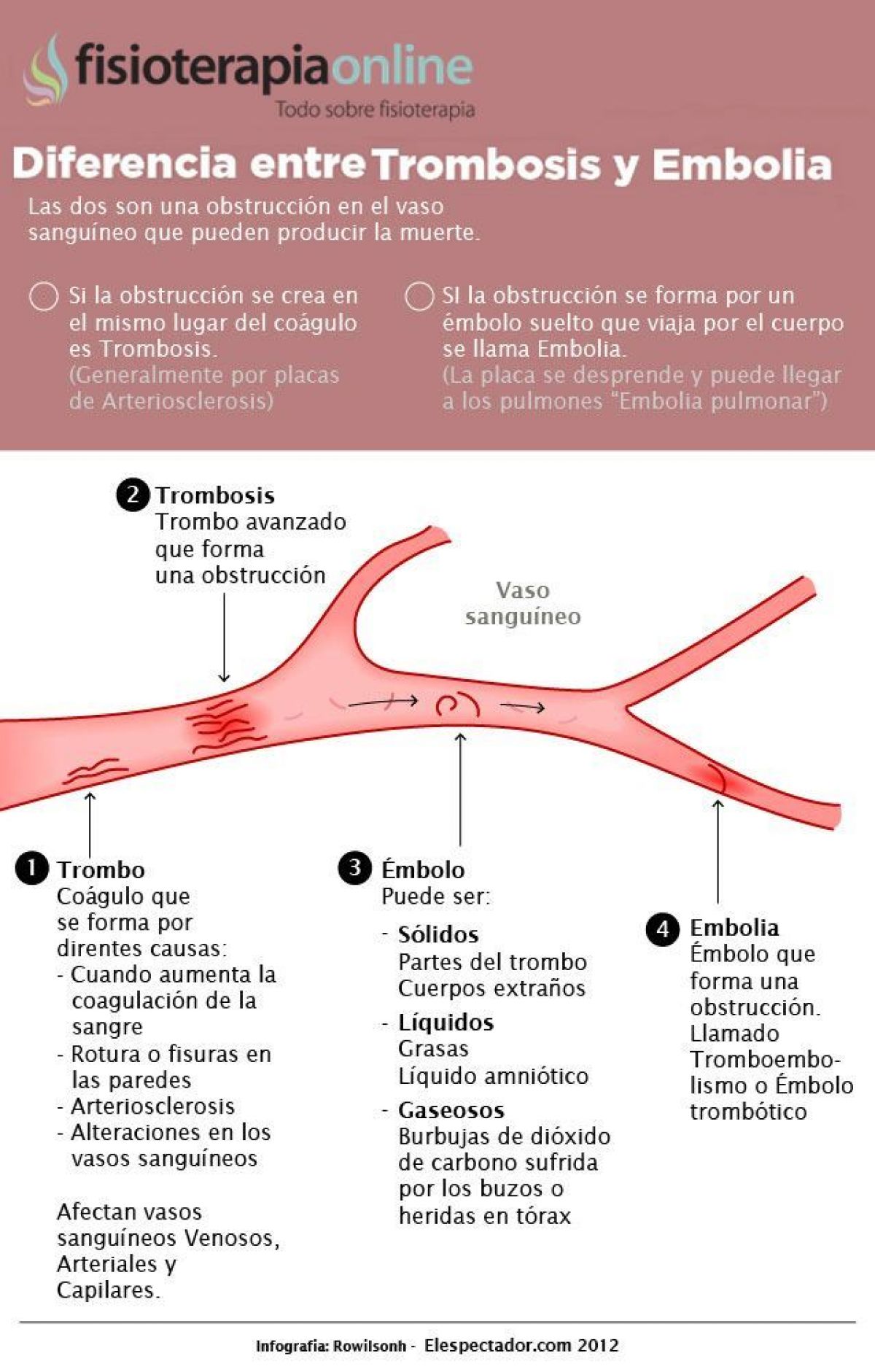 Trombosis o embolia