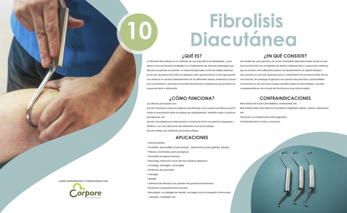 Fibrolisis Diacutanea o Técnica de ganchos. Te ayuda más de lo que te asusta