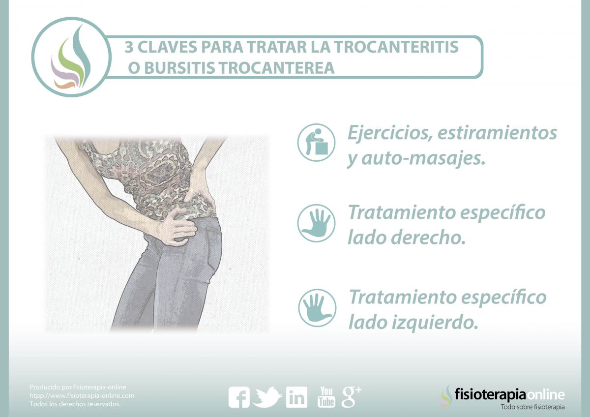 3 claves para tratar la trocanteritis o bursitis trocantérea