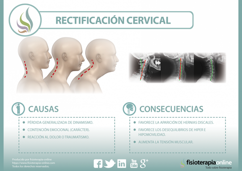 Dolor cervical: Causas, síntomas y tratamiento