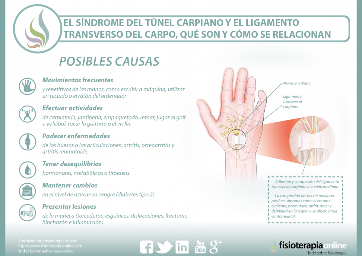 El síndrome del túnel carpiano y el ligamento transverso del carpo, aprende qué son y cómo se relacionan