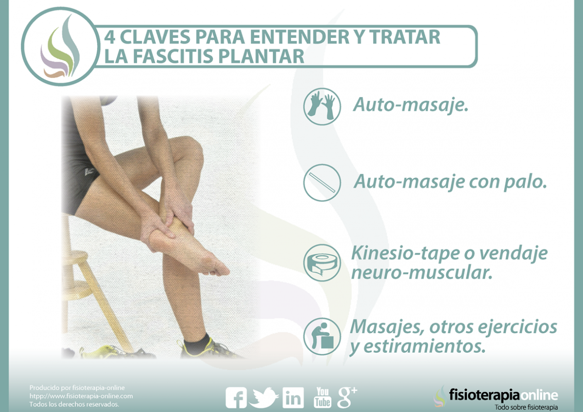 4 claves para entender y tratar la fascitis plantar