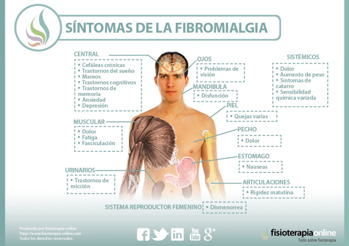 Fibromialgia. Causas, sintomas, diagnóstico y tratamiento