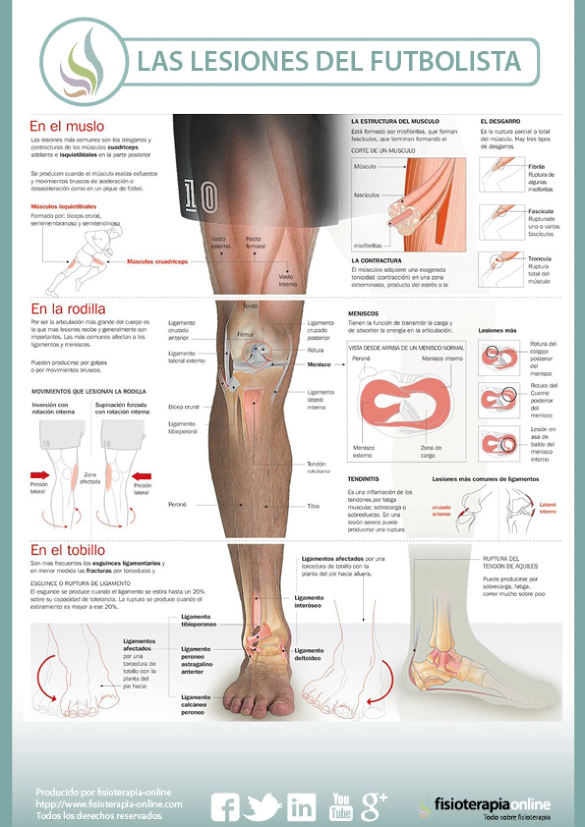 dolor en la rodilla al jugar futbol