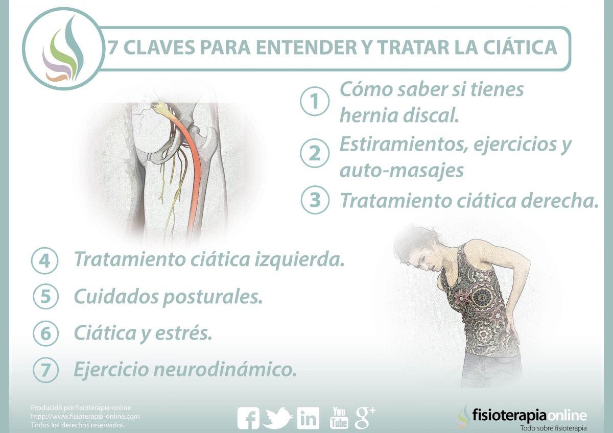 7 claves para entender y tratar la ciática