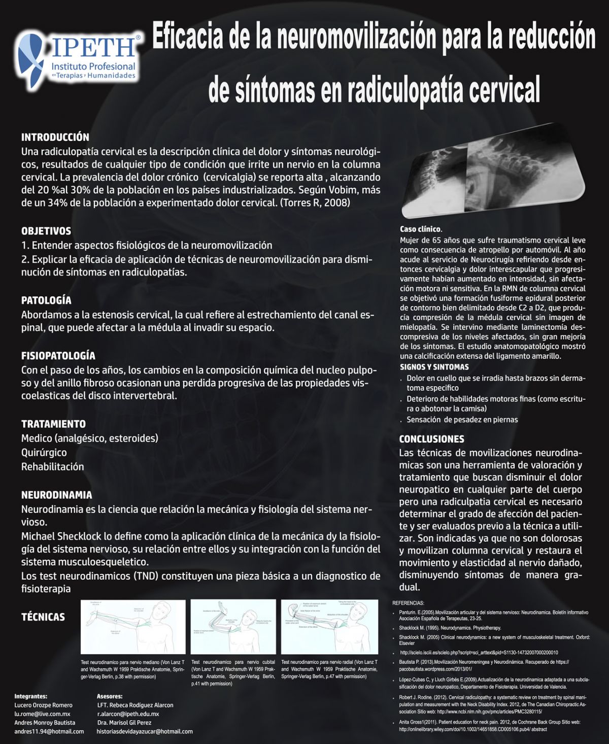 Eficacia de la neurodinamia para la reducción de síntomas en radiculopatia cervical