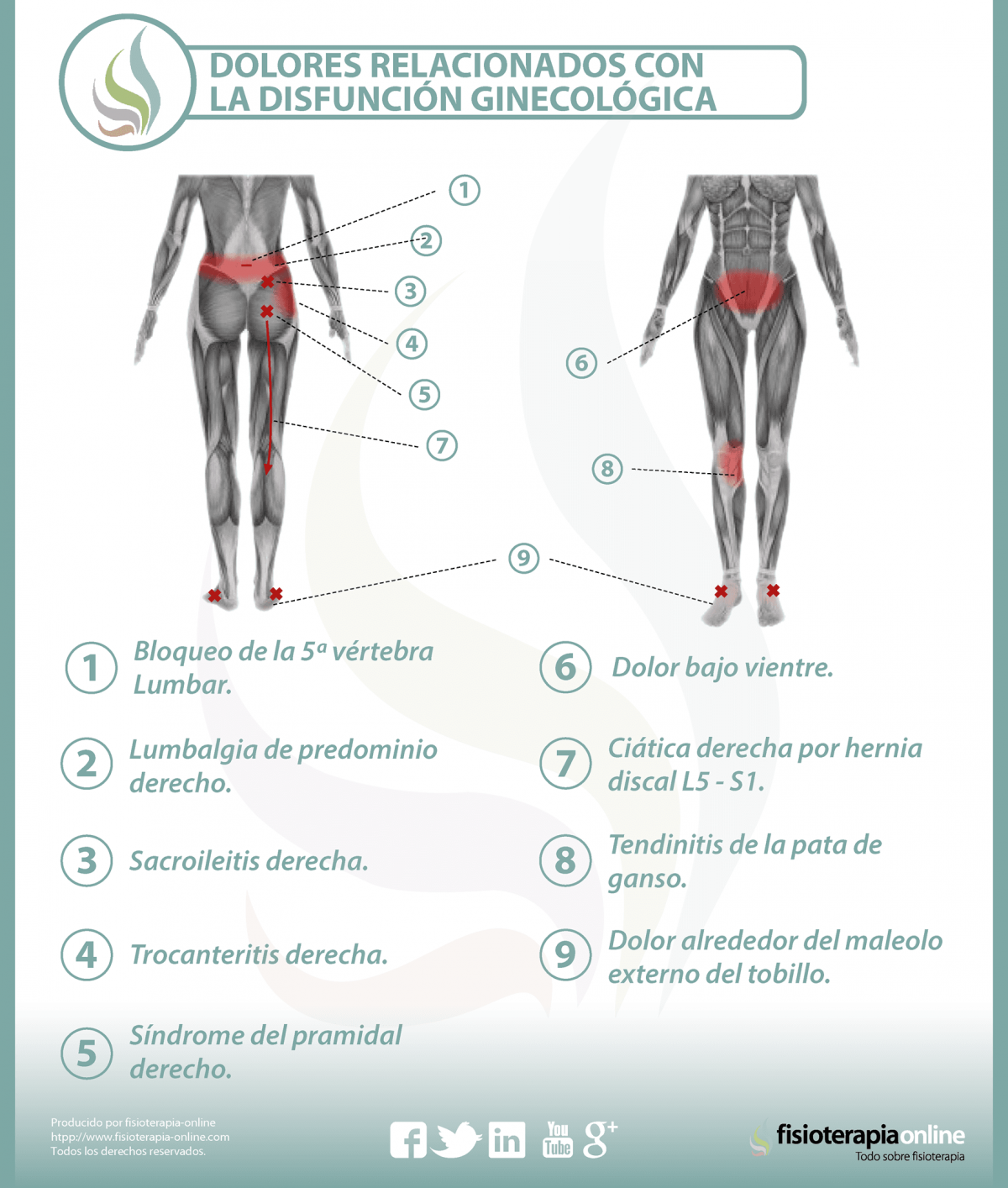 Relación entre el útero y el dolor de espalda