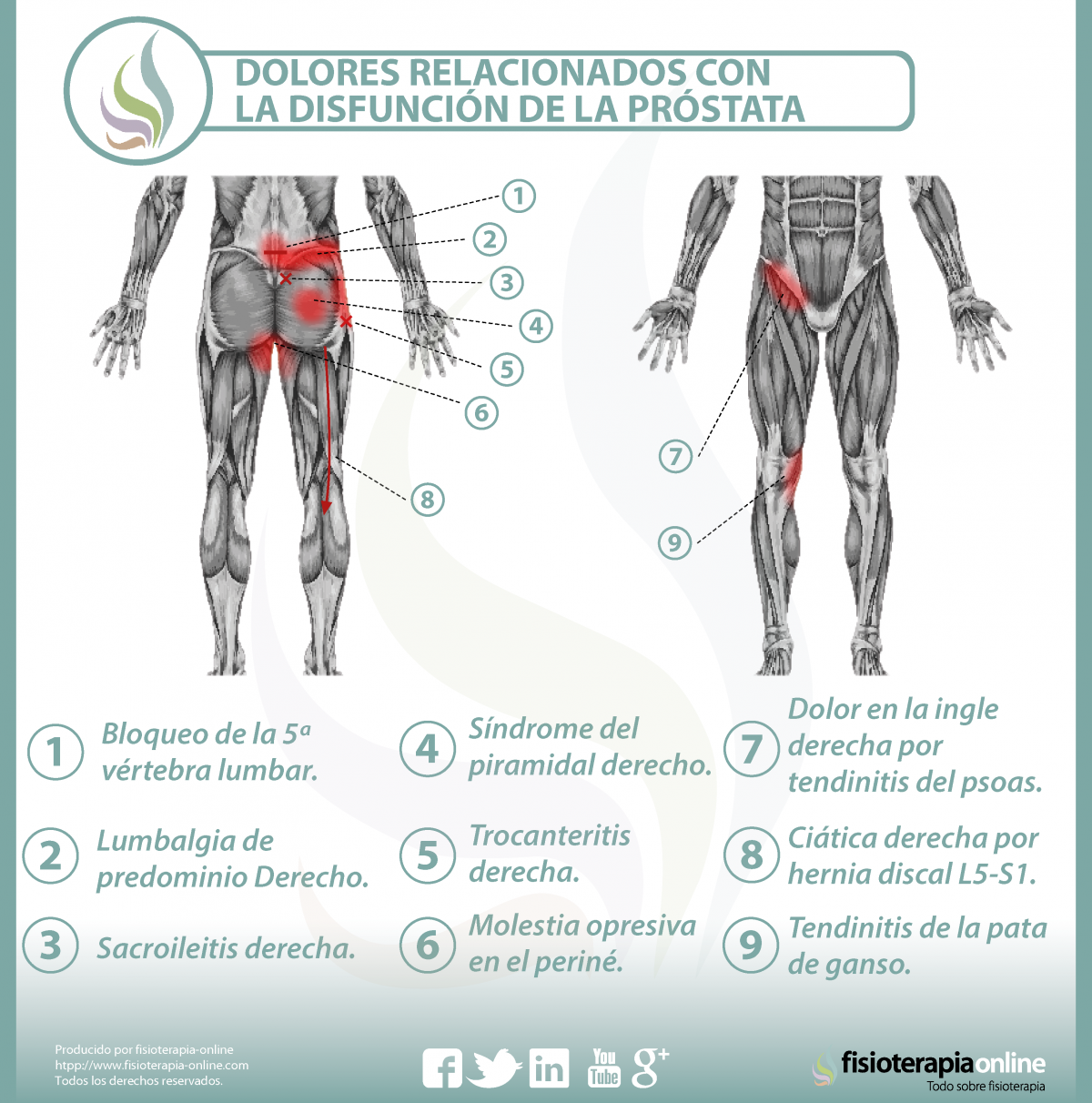 Relación entre próstata y dolor de espalda