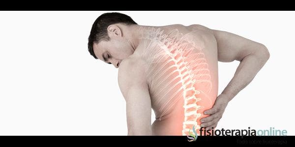 ¿En qué consiste el tratamiento de fisioterapia del acuñamiento vertebral?