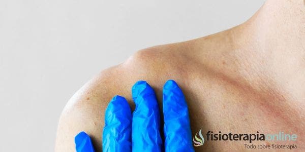 ¿Cómo evitar algunas de las complicaciones que acompañan a las fracturas de clavícula?