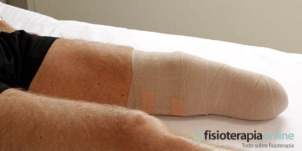 ¿Cómo se debe cuidar el muñon después de una amputación tibial?