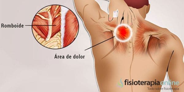 Reeducación postural global en el dolor interescapular