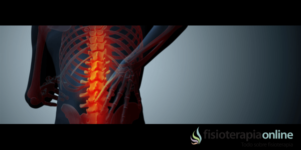 Estenosis foraminal ¿Cómo se puede movilizar la columna cuando hay dolor lumbar?