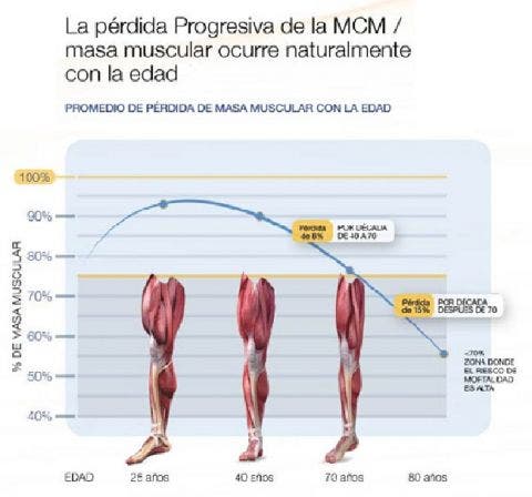 Artrosis ¿Un problema articular o muscular? ¿Qué es la Artrosis ¿Un problema articular o muscular? ¿Qué es la