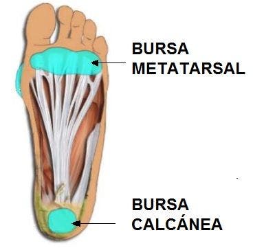 Pie cavo, excavado o hueco: qué es y tratamiento en fisioterapia