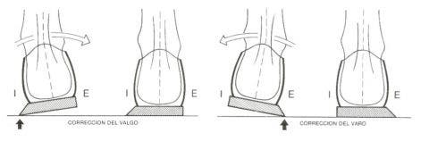 Pie cavo, excavado o hueco: qué es y tratamiento en fisioterapia