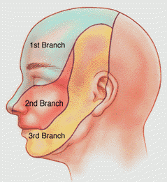 Tipos de neuralgias Tipos de neuralgias