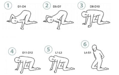 Posturas y ejercicios de Klap para el tratamiento de escoliosis