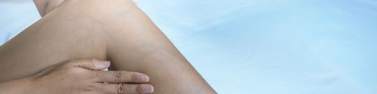 Trombosis venosa profunda