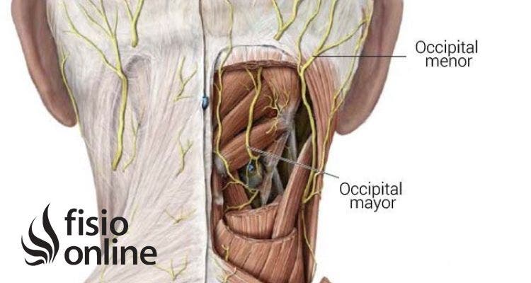 Neuralgia de Arnold 