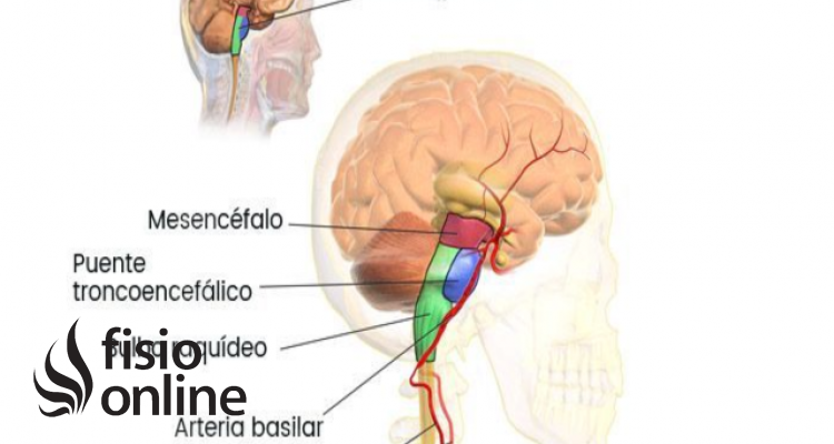 arteria vertebro basilar