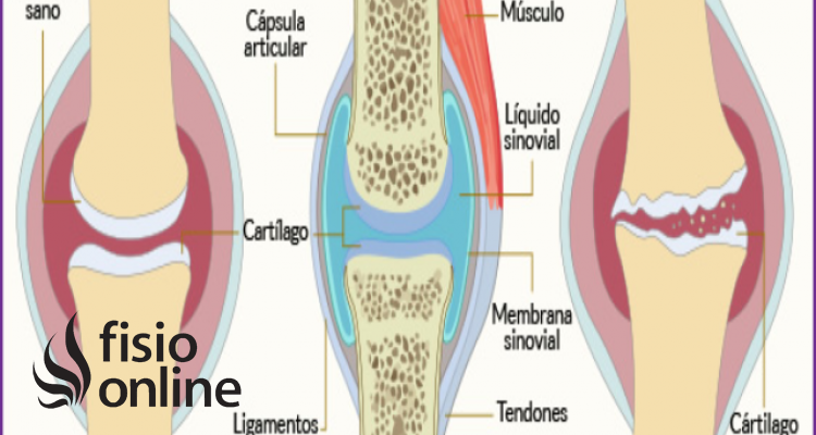 menos formato Anunciante Cartílago articular | Qué es, ubicación, componentes, función y lesiones