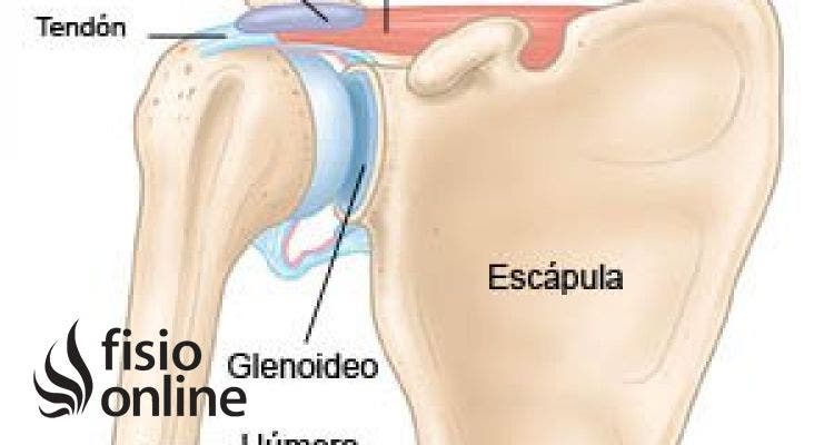 Fractura de hombro