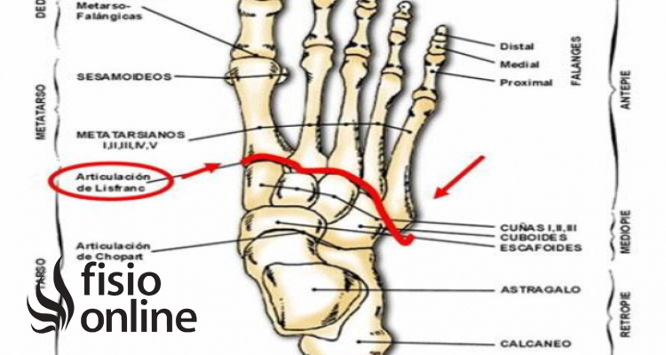 Interlínea de Lisfranc