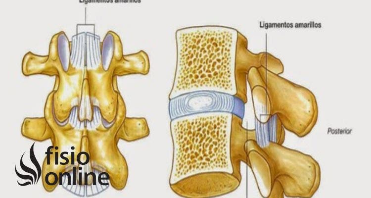 Ligamento Amarillo 