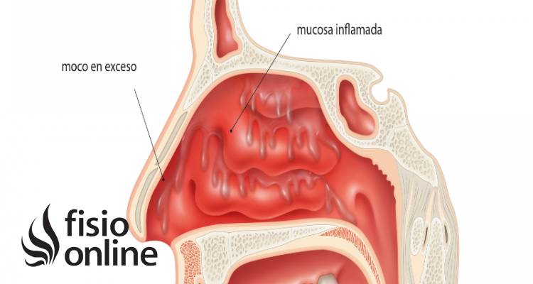 Capa mucosa