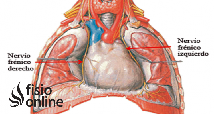 lesión del nervio frénico