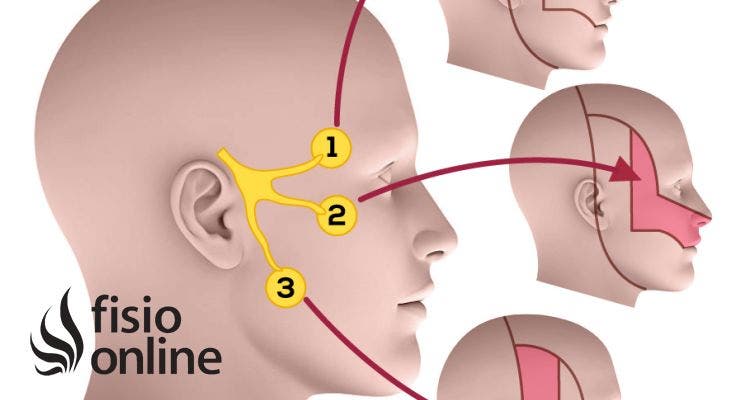 Neuralgia del trigémino