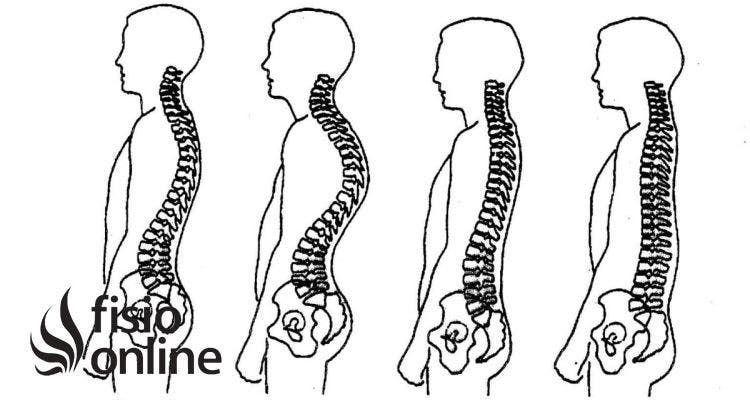 Rectificación dorsal