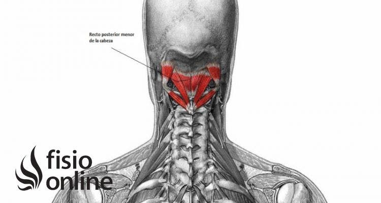 músculo recto posterior menor de la cabeza