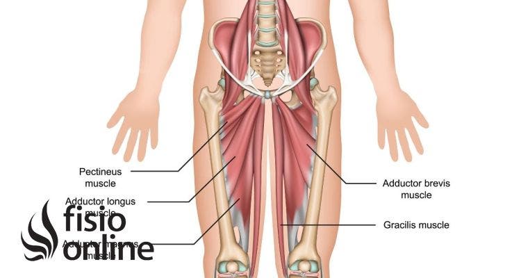 Rotura de fibras aductoras