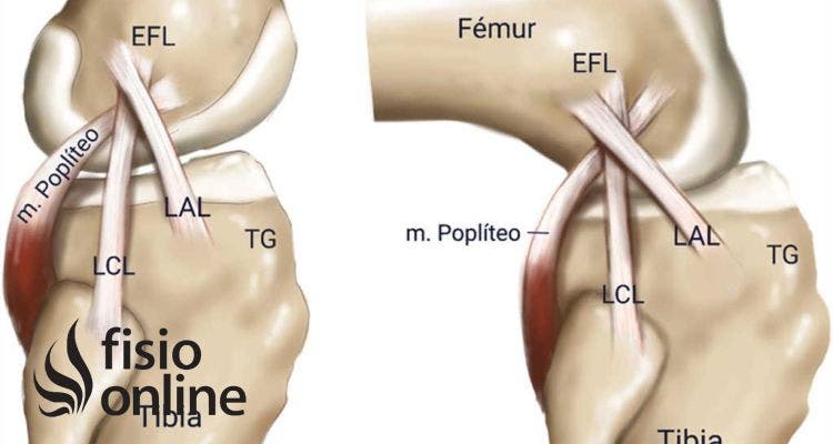 Rotura ligamento colateral externo 