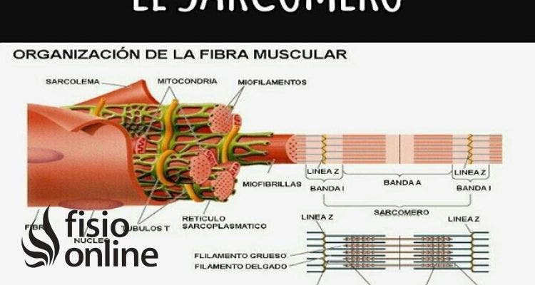 sarcómero